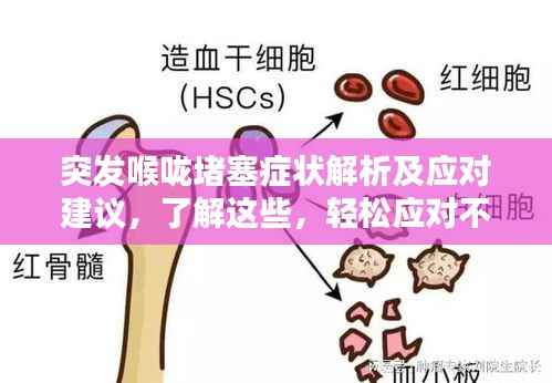 突发喉咙堵塞症状解析及应对建议,了解这些,轻松应对不适!